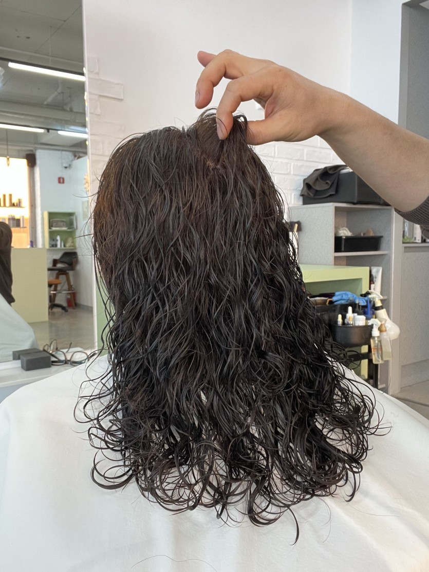 청주시 여자 미디레이어컷 추천 시술 사례 이미지 2