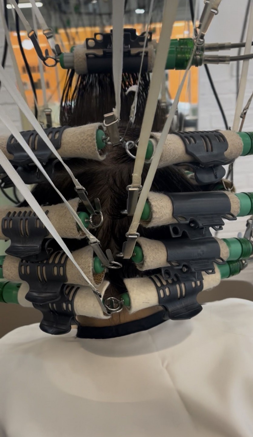 청주시 여자 CS컬펌 시술 사례 이미지 1